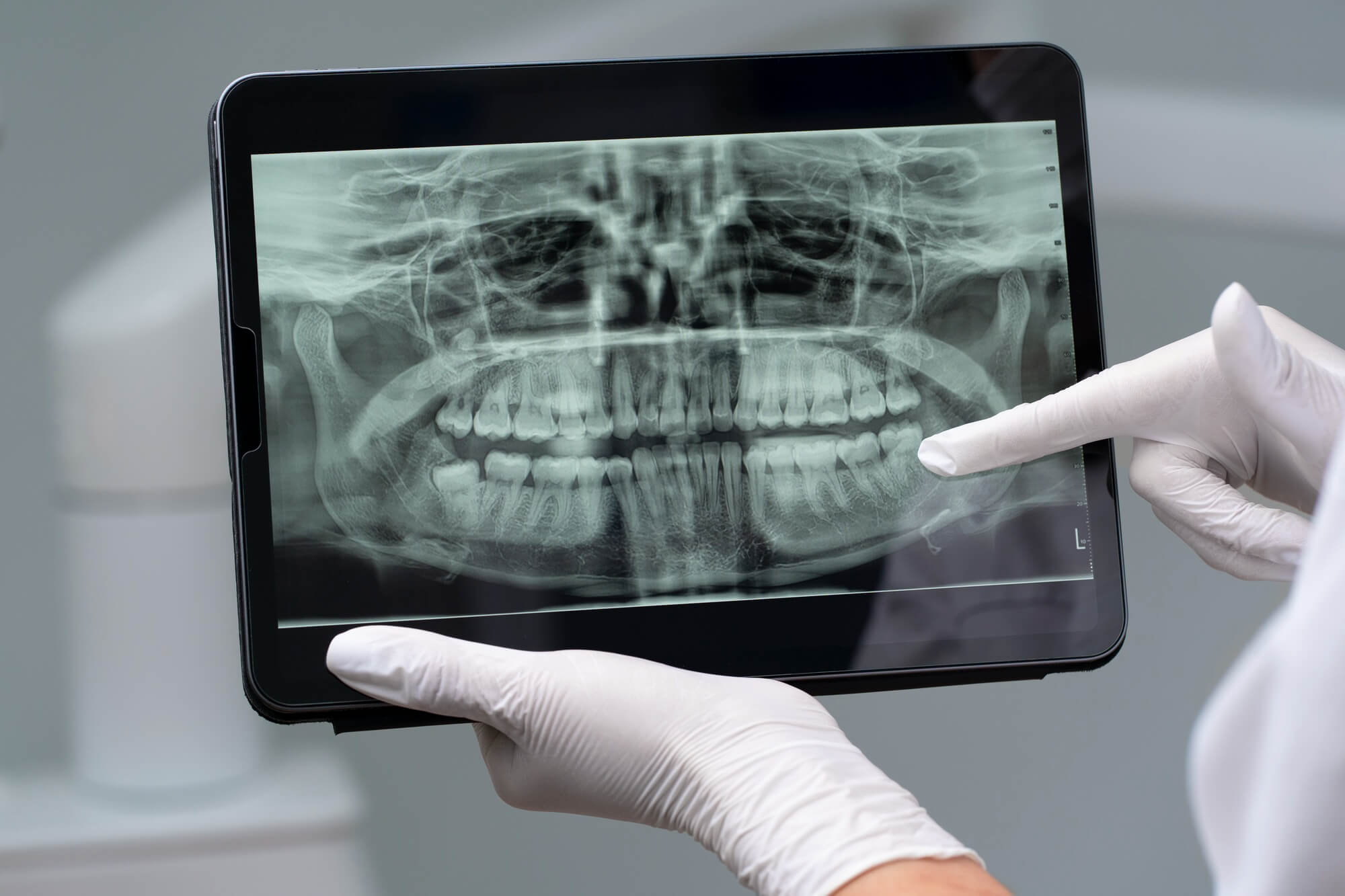 Maxilofacial Fuengirola - Maxilofacial Fuengirola 2151042898 (1)